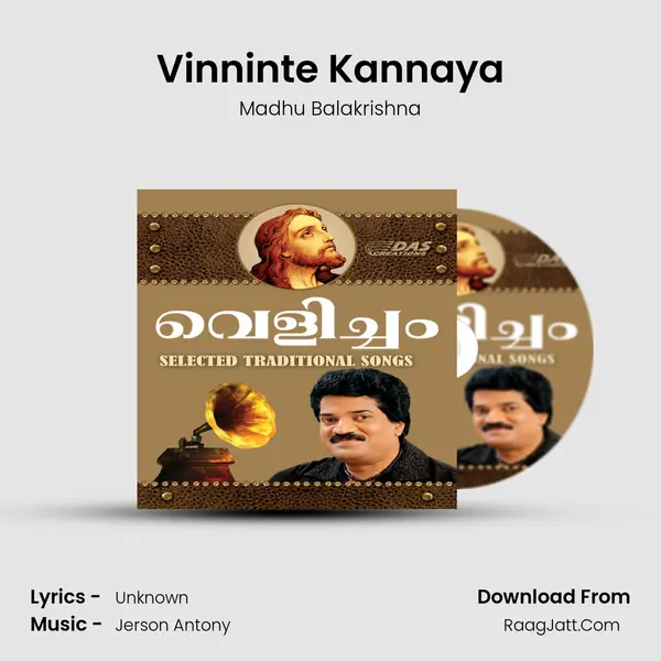 Vinninte Kannaya MP3 Song by Madhu Balakrishna Cover